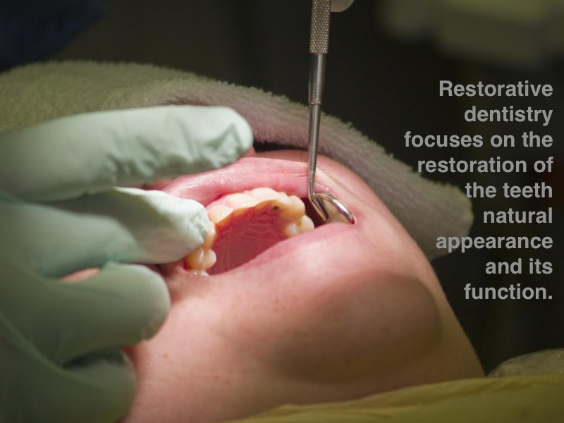 Different restorative treatments | Dental Care of Chino Hills