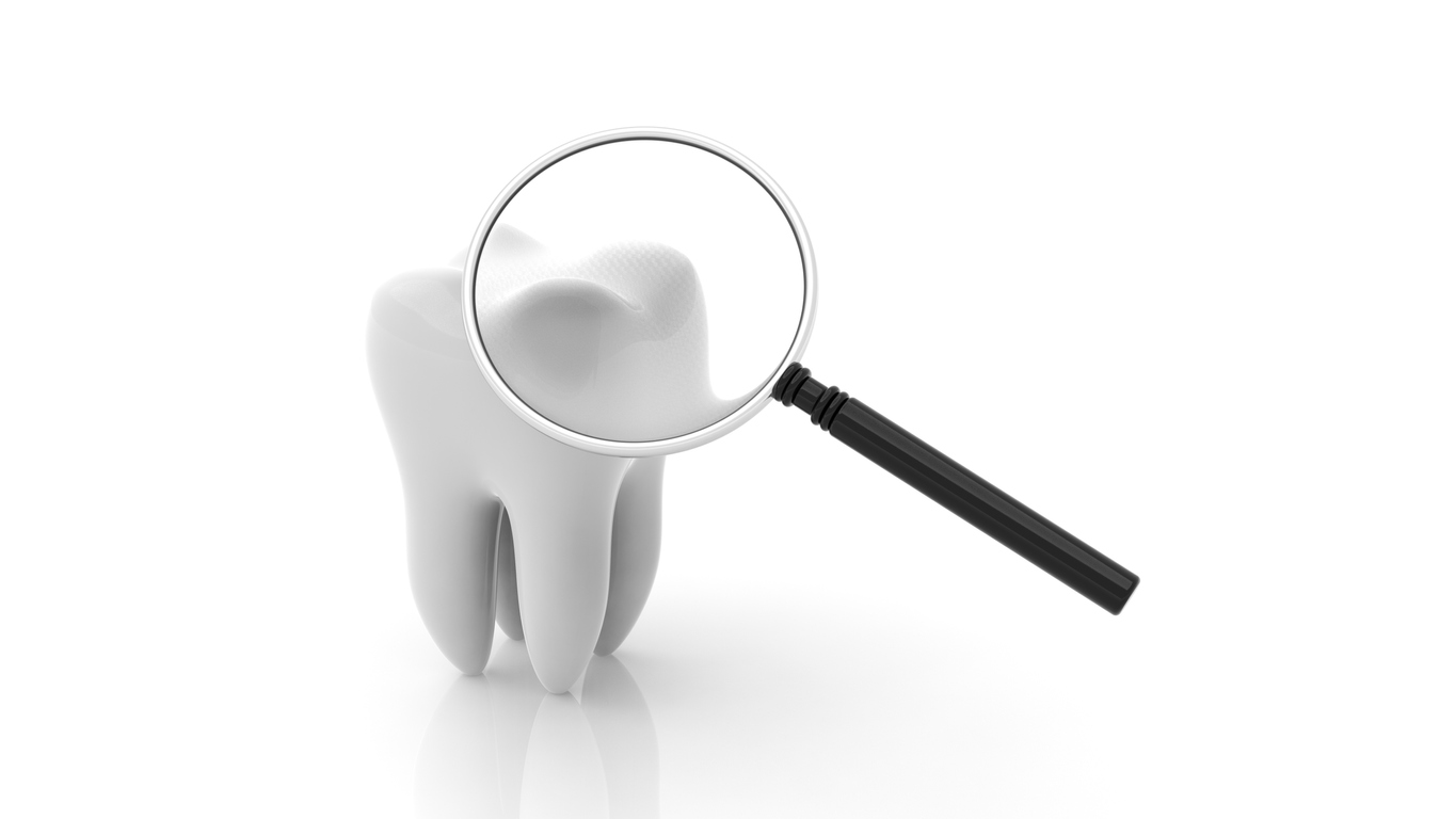 Magnifying glass on tooth looking for thin enamel