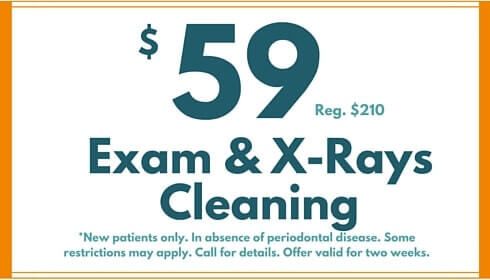 $59 reg. $210, exam & x-rays cleaning, new patients only, in absence of periodontal disease, some restrictions may apply, call for details, offer valid for two weeks