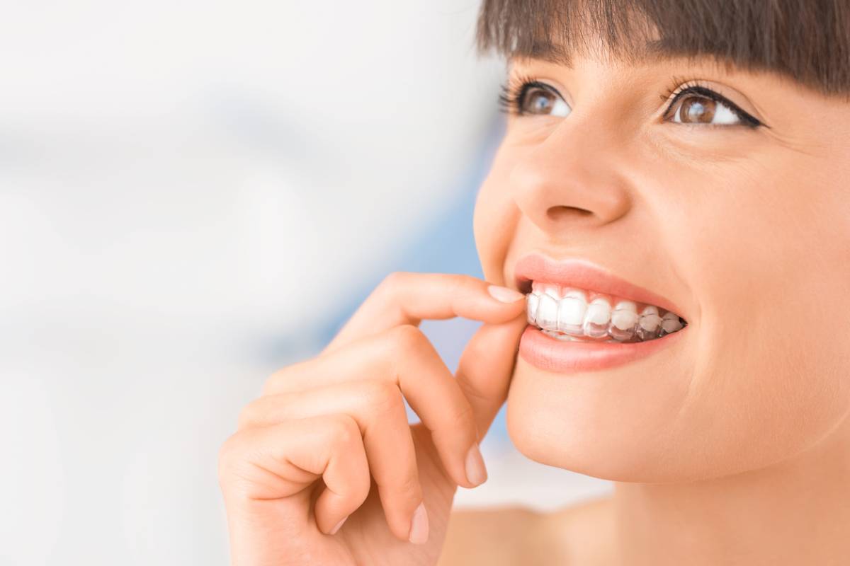 woman adjusting invisalign tray on upper teeth