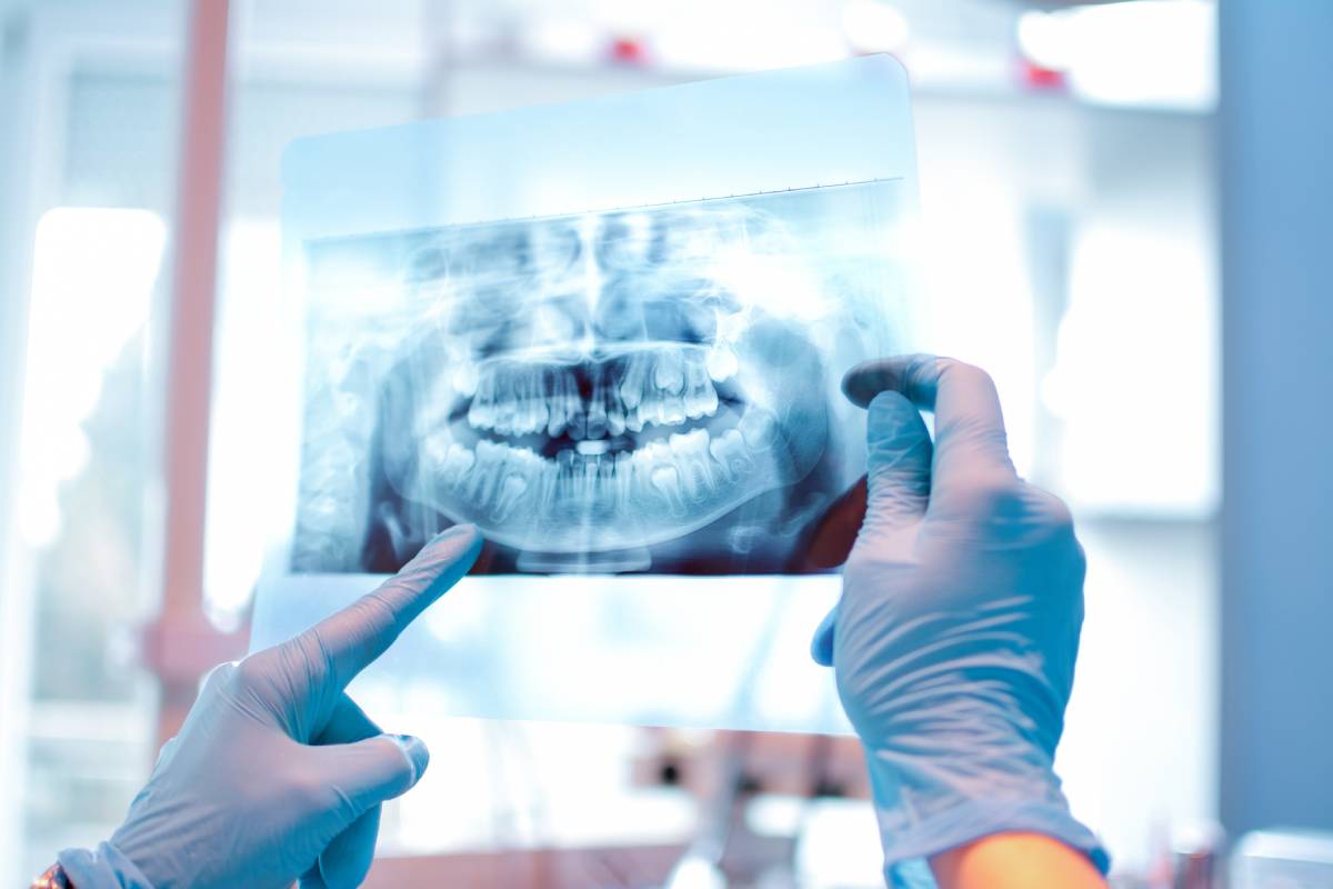 concept image of purpose of dental x-rays