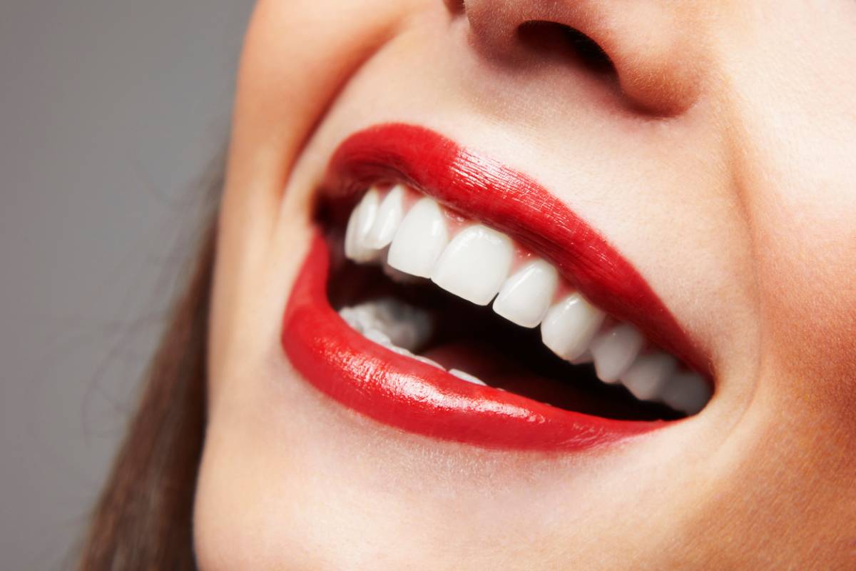 concept of whiter teeth after whitening