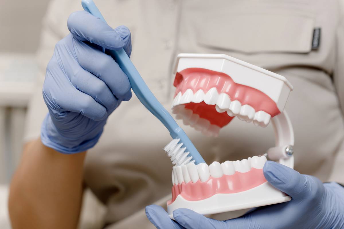featured image for 5 tips for dental bonding aftercare