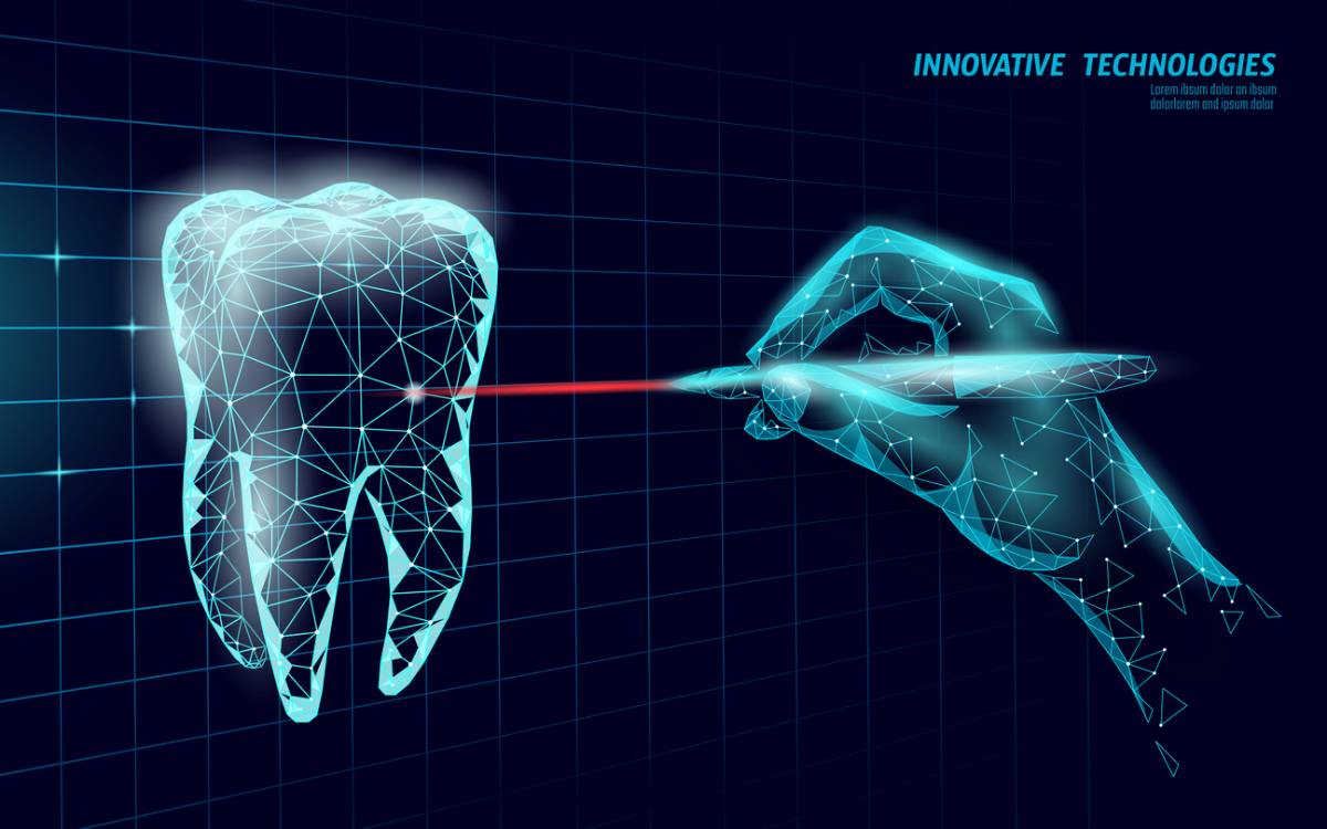 featured image for top 5 benefits of laser dentistry